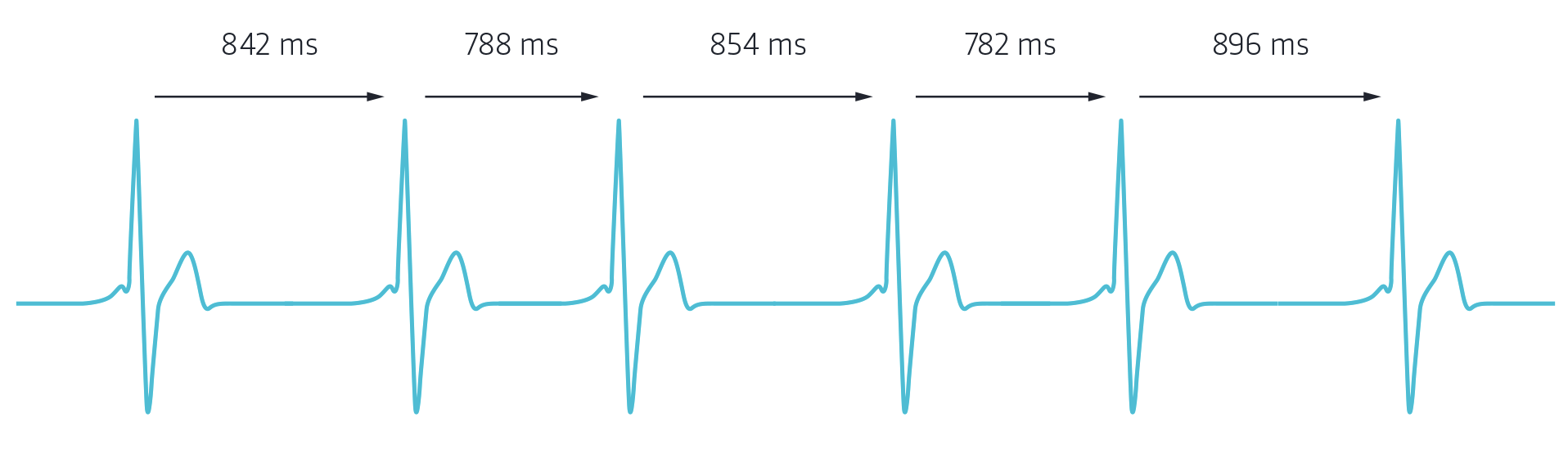 Berechnung der Herzfrequenzvariabilität anhand der R-Zacken-Analyse in Millisekunden. 