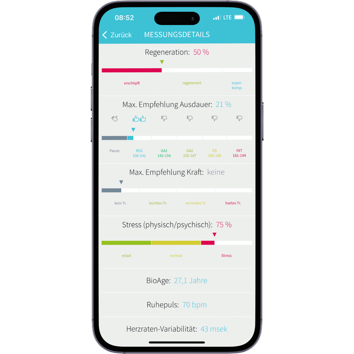 HRV-App Vitalmonitor - niedrige HRV - schlechtes Messergebnis